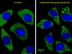 Invitrogen ATG7 Polyclonal Antibody 400 &mu;L; Unconjugated:Antibodies,