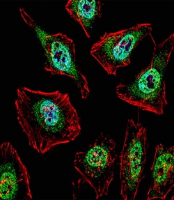 Invitrogen TFE3 Polyclonal Antibody 400 μL; Unconjugated:Antibodies,