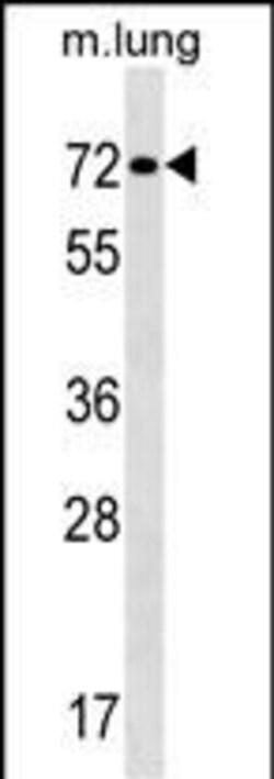 Invitrogen TFE3 Polyclonal Antibody 400 μL; Unconjugated:Antibodies,