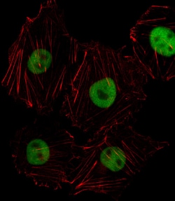 Invitrogen HOXD8 Polyclonal Antibody 400 &mu;L; Unconjugated:Antibodies,