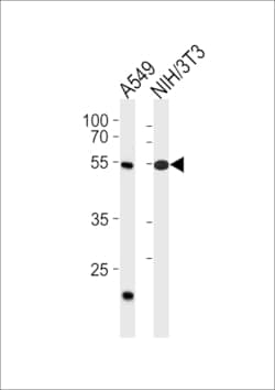 Invitrogen TBX4 Polyclonal Antibody 400 μL; Unconjugated:Antibodies,