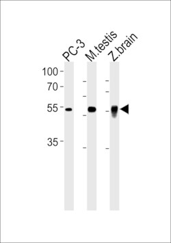 Invitrogen DMRTA2 Polyclonal Antibody 400 μL; Unconjugated:Antibodies,