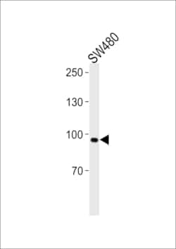 Invitrogen ANO6 Polyclonal Antibody 400 &mu;L; Unconjugated:Antibodies,