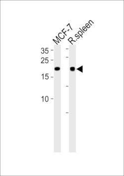 Invitrogen ZNF9 Polyclonal Antibody 400 &mu;L; Unconjugated:Antibodies,