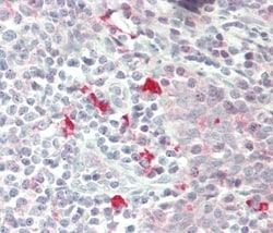 Invitrogen ZRSR2 Polyclonal Antibody 400 &mu;L | Buy Online | Invitrogen&trade; | Fisher Scientific