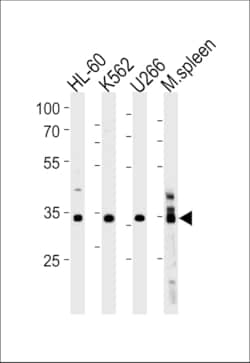Invitrogen GFI1B Polyclonal Antibody 400 &mu;L; Unconjugated:Antibodies,