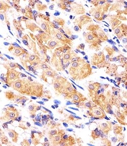 Invitrogen RPLP0P6 Polyclonal Antibody 400 &mu;L; Unconjugated:Antibodies,