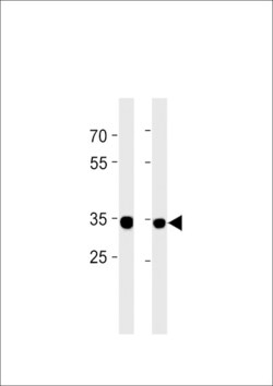Invitrogen RPLP0P6 Polyclonal Antibody 400 &mu;L; Unconjugated:Antibodies,