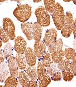 Invitrogen SIRPB1 Polyclonal Antibody 400 &mu;L; Unconjugated:Antibodies,