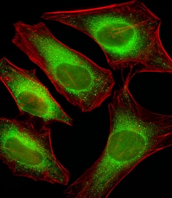 Invitrogen USP51 Polyclonal Antibody 400 &mu;L; Unconjugated:Antibodies,