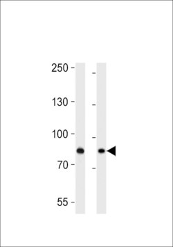 Invitrogen USP51 Polyclonal Antibody 400 &mu;L; Unconjugated:Antibodies,