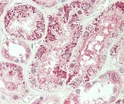 Invitrogen PKP4 Polyclonal Antibody 400 &mu;L; Unconjugated:Antibodies,