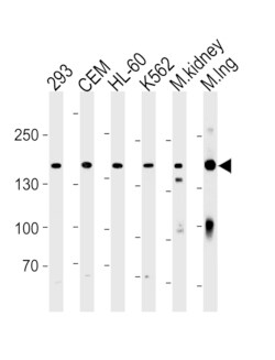 Invitrogen PKP4 Polyclonal Antibody 400 &mu;L; Unconjugated:Antibodies,