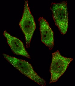 Invitrogen APRT Polyclonal Antibody 400 &mu;L; Unconjugated:Antibodies,