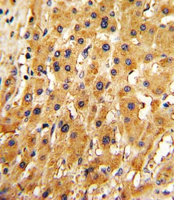 Invitrogen APRT Polyclonal Antibody 400 &mu;L; Unconjugated:Antibodies,