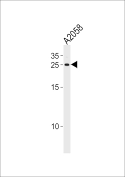 Invitrogen APRT Polyclonal Antibody 400 &mu;L; Unconjugated:Antibodies,