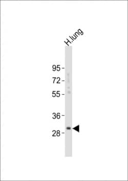 Invitrogen Kallikrein 6 Polyclonal Antibody 400 &mu;L; Unconjugated:Antibodies,
