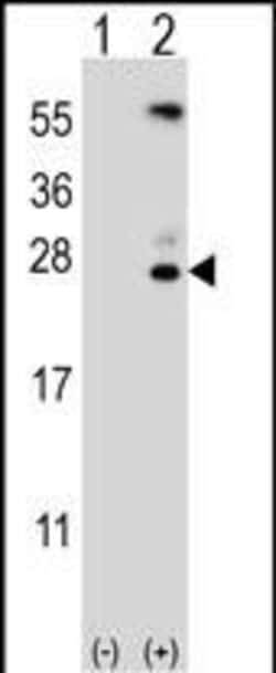 Invitrogen Kallikrein 6 Polyclonal Antibody 400 &mu;L; Unconjugated:Antibodies,