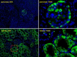 Invitrogen Transthyretin Polyclonal Antibody 400 &mu;L; Unconjugated:Antibodies,