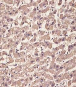 Invitrogen Transthyretin Polyclonal Antibody 400 &mu;L; Unconjugated:Antibodies,