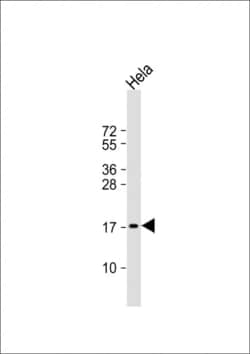 Invitrogen PTP4A2 Polyclonal Antibody 400 &mu;L; Unconjugated:Antibodies,