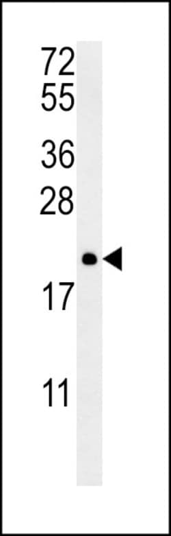 Invitrogen PTP4A2 Polyclonal Antibody 400 &mu;L; Unconjugated:Antibodies,