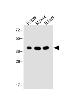Invitrogen OTC Polyclonal Antibody 400 &mu;L; Unconjugated:Antibodies,