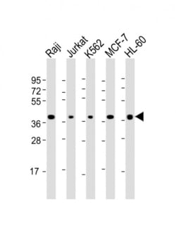 Invitrogen CD62L Polyclonal Antibody 200 &mu;L | Buy Online | Invitrogen&trade; | Fisher Scientific