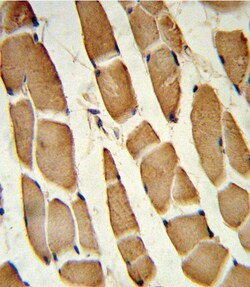 Invitrogen SMAD4 Polyclonal Antibody 400 &mu;L; Unconjugated:Antibodies,