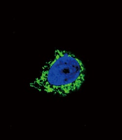 Invitrogen IGFBP2 Polyclonal Antibody 400 &mu;L; Unconjugated:Antibodies,