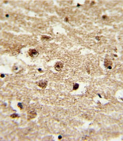 Invitrogen IGFBP2 Polyclonal Antibody 400 &mu;L; Unconjugated:Antibodies,