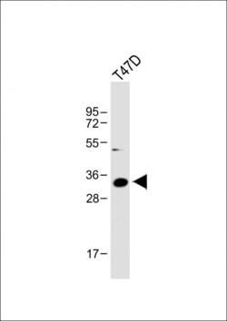 Invitrogen IGFBP2 Polyclonal Antibody 400 &mu;L; Unconjugated:Antibodies,