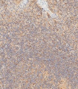 Invitrogen HLA-B Polyclonal Antibody 400 &mu;L; Unconjugated:Antibodies,