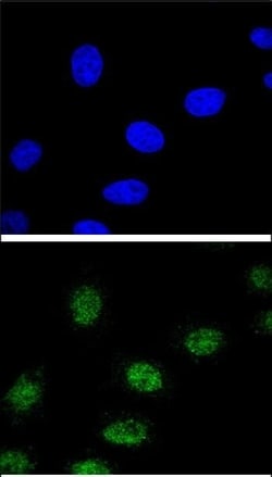 Invitrogen ESRRA Polyclonal Antibody 400 &mu;L; Unconjugated:Antibodies,