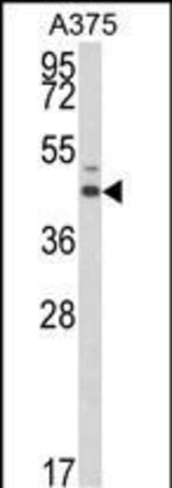 Invitrogen ESRRA Polyclonal Antibody 400 &mu;L; Unconjugated:Antibodies,