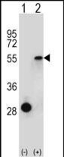 Invitrogen ESRRA Polyclonal Antibody 400 &mu;L; Unconjugated:Antibodies,