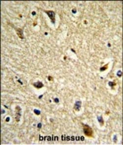 Invitrogen CYP2E1 Polyclonal Antibody 400 &mu;L | Buy Online | Invitrogen&trade; | Fisher Scientific