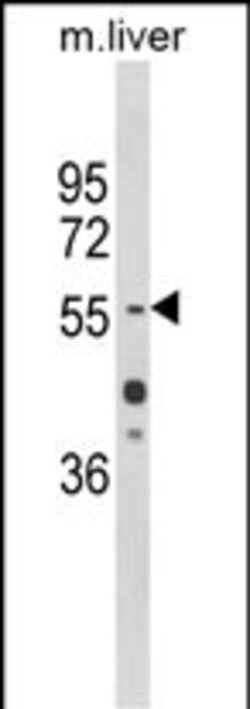 Invitrogen HNF1A Polyclonal Antibody 400 &mu;L; Unconjugated:Antibodies,