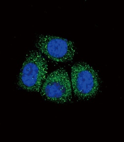 Invitrogen alpha-ENaC Polyclonal Antibody 400 &mu;L; Unconjugated:Antibodies,