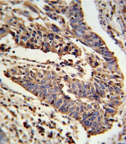 Invitrogen alpha-ENaC Polyclonal Antibody 400 &mu;L; Unconjugated:Antibodies,