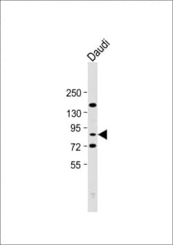 Invitrogen alpha-ENaC Polyclonal Antibody 400 &mu;L; Unconjugated:Antibodies,