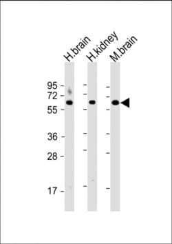 Invitrogen Glutaminase Polyclonal Antibody 200 &mu;L; Unconjugated:Antikroppar