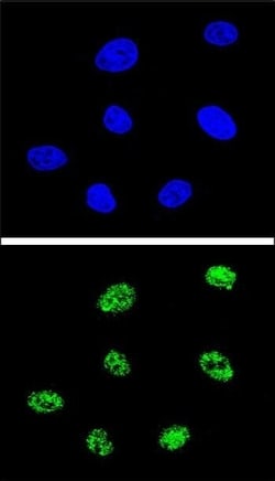 Invitrogen p73 Polyclonal Antibody 400 &mu;L; Unconjugated:Antibodies,