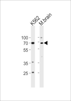 Invitrogen p73 Polyclonal Antibody 400 &mu;L; Unconjugated:Antibodies,
