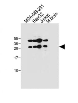 Invitrogen EMX1 Polyclonal Antibody 400 &mu;L; Unconjugated:Antibodies,