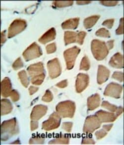 Invitrogen PDK2 Polyclonal Antibody 400 &mu;L; Unconjugated:Antibodies,