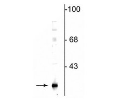 Invitrogen GSTK1 Polyclonal Antibody 100 &mu;L; Unconjugated:Antibodies,