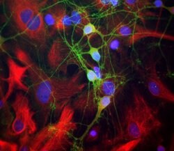 Invitrogen alpha-II Spectrin Polyclonal Antibody 100 &mu;L; Unconjugated:Antibodies,