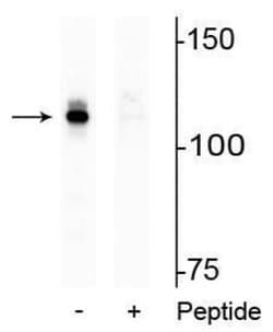 Invitrogen Phospho-Androgen Receptor (Ser94) Polyclonal Antibody 100 &mu;L;
