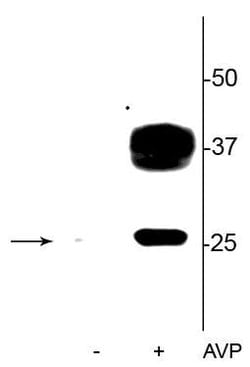 Invitrogen&trade;&nbsp;Phospho-Aquaporin 2 (Ser269) Polyclonal Antibody